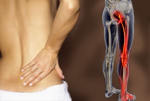 webmd_rm_photo_of_lower_back_pain-300×203 webmd rm photo of lower back pain 300x203 1
